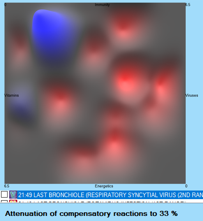 2020WP-3DrespirsyncTOP